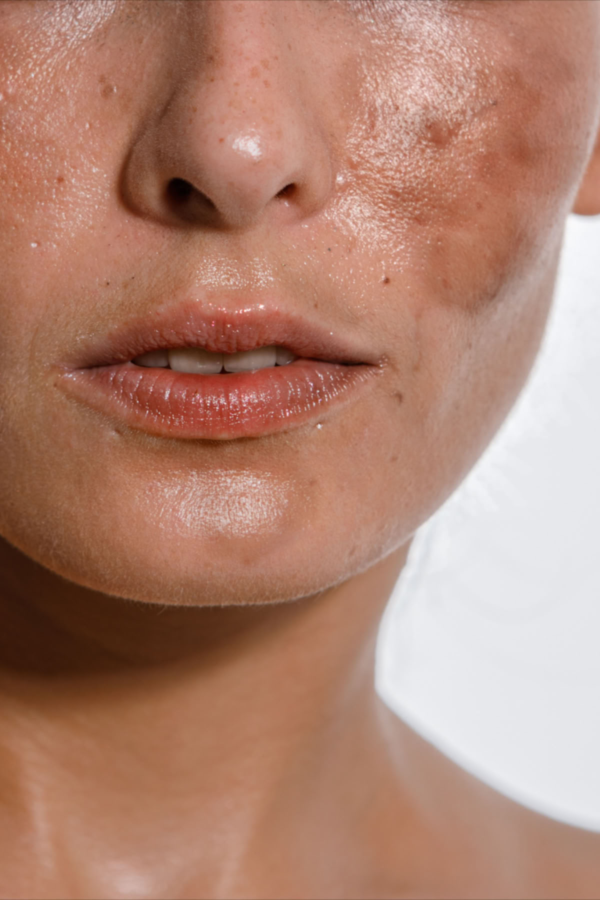 Tratamiento Facial: Mejora manchas en 21 días