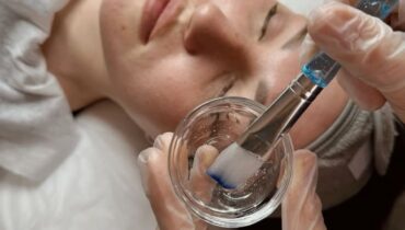 Tratamiento Facial: Peeling para invierno para mayor seguridad y eficacia